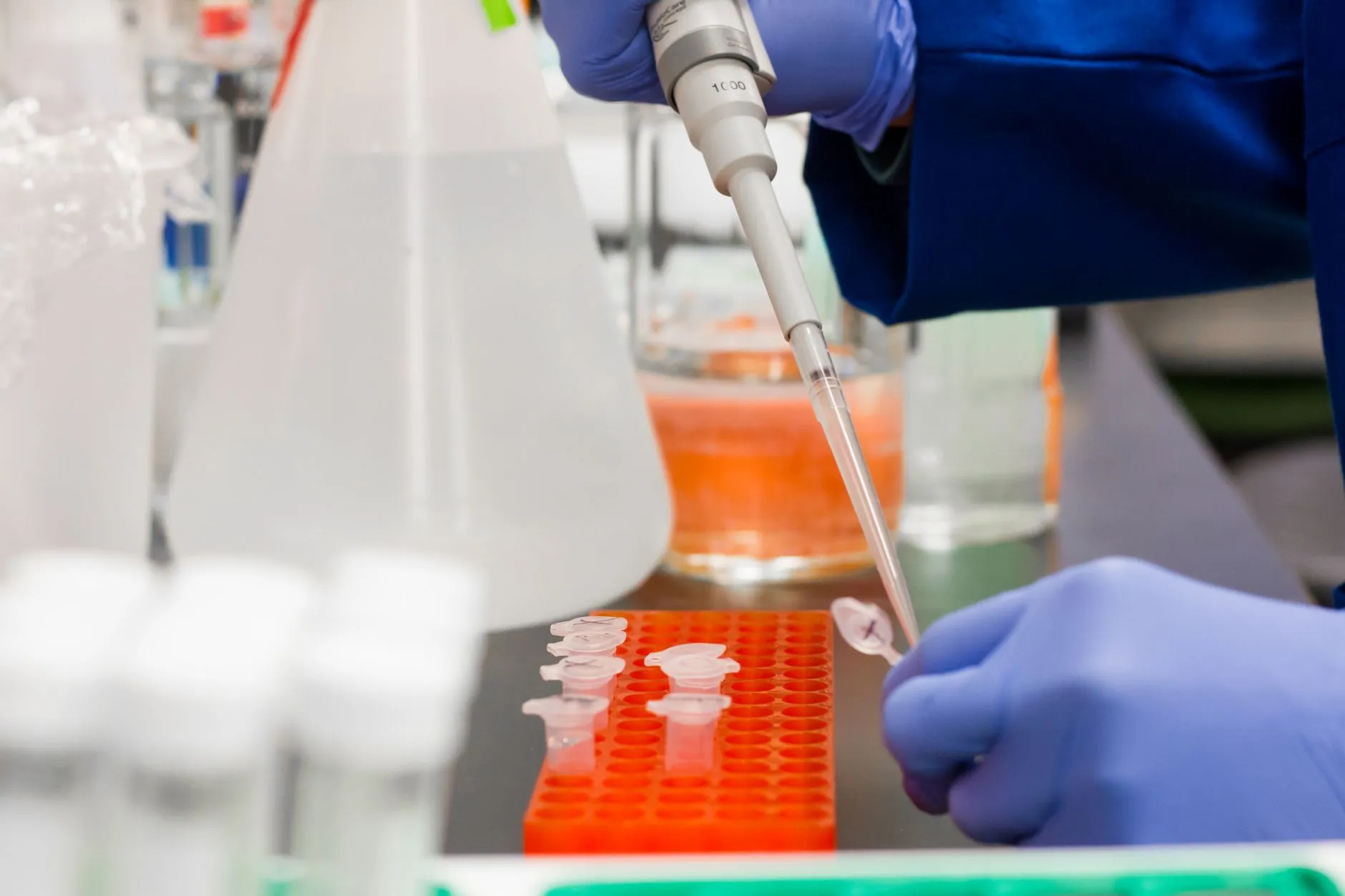 无锡恒美生物标准品与抗原抗体在医学检验实验室的应用方案